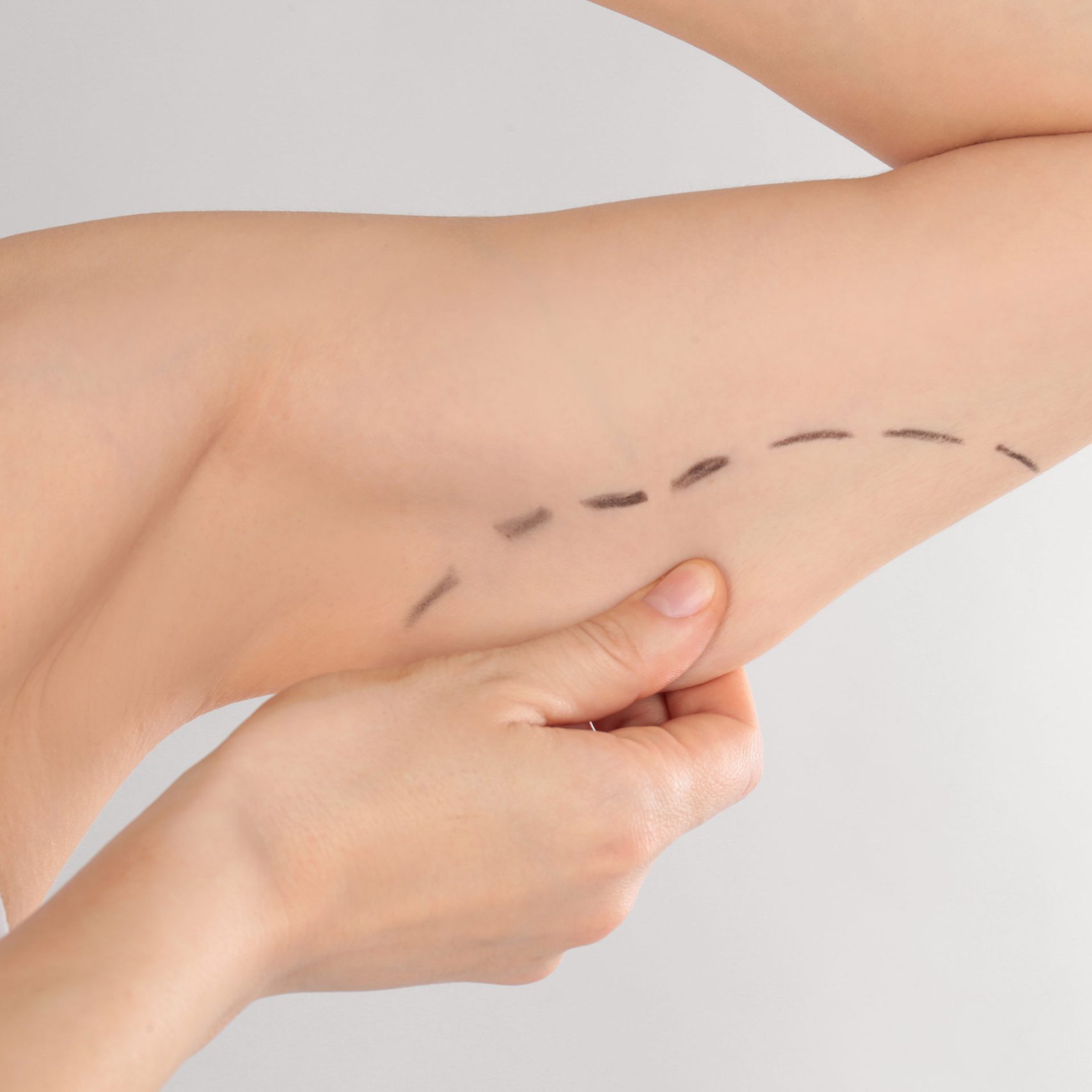 285944607_Oberarmstraffung_Aeshetische_Chirurgie-scaled